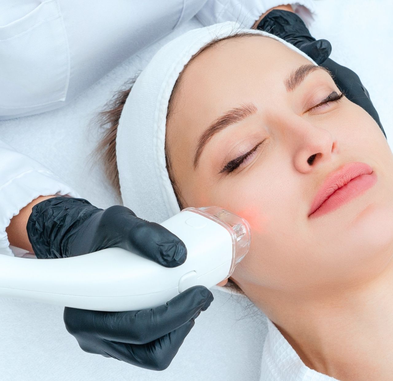 Trattamenti laser macchie e cicatrici: differenze, risultati e consulenza individuale